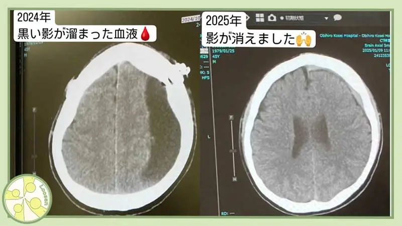 十勝･帯広市の整体,スポーツ運動パフォーマンスが向上する身体の使い方,からだの相談室Loosen,植原良